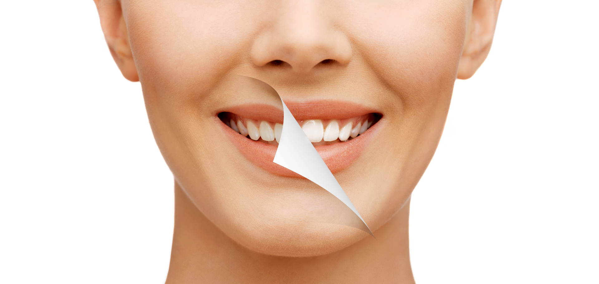 Diş  Beyazlatma Yöntemleri Nelerdir? | Minepol