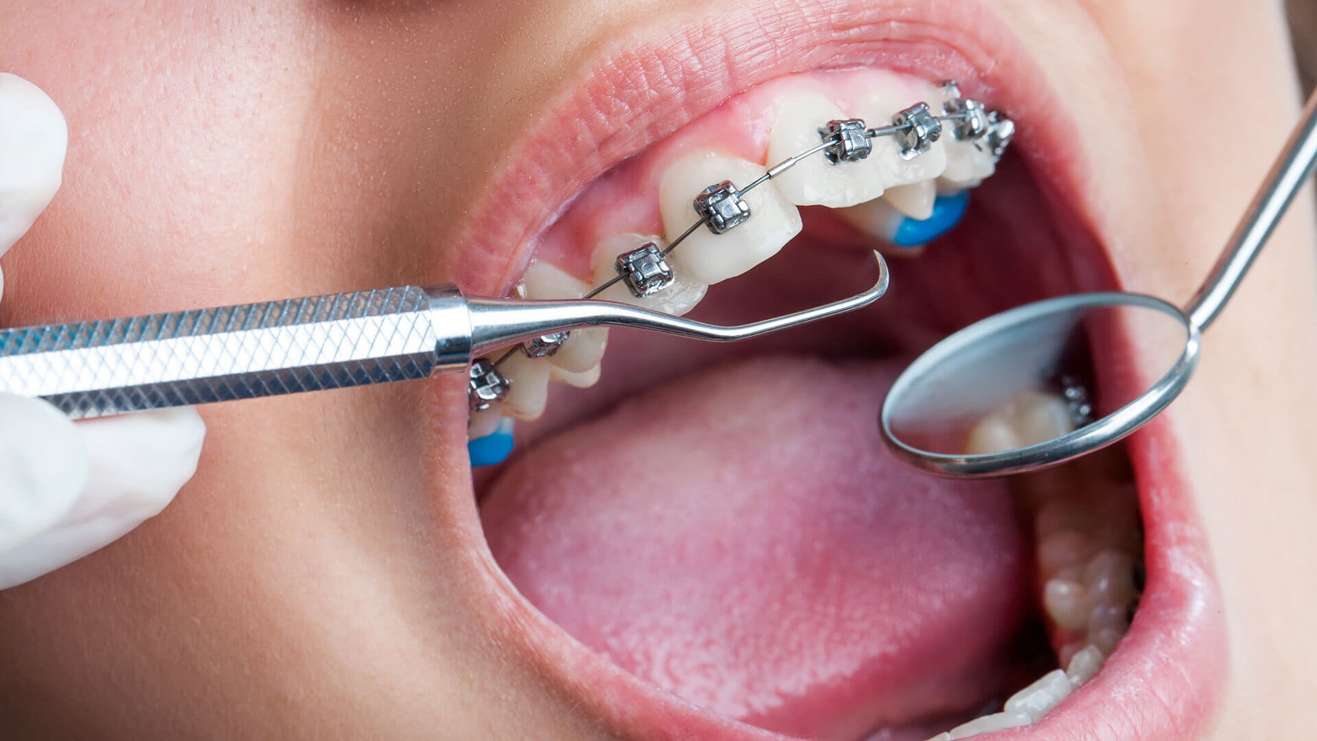 Ortodonti | Minepol